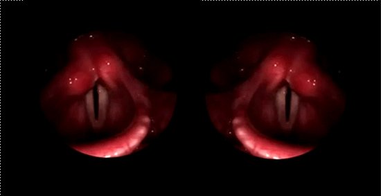 Erin Gee - eye is a throat is a twin